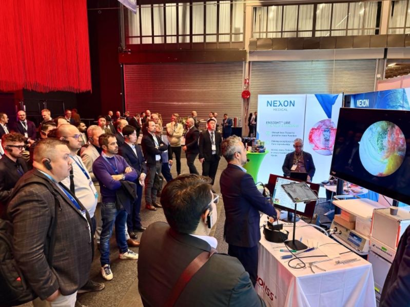 Large audience at a live biportal endoscopy session with endoscopic view on screen in the UBE Arena, EUROSPINE 2026